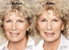 Amazing results, Mackay Skin Clinic - Mackay